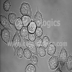 Wild Type Mouse Bone Marrow Cells (1)